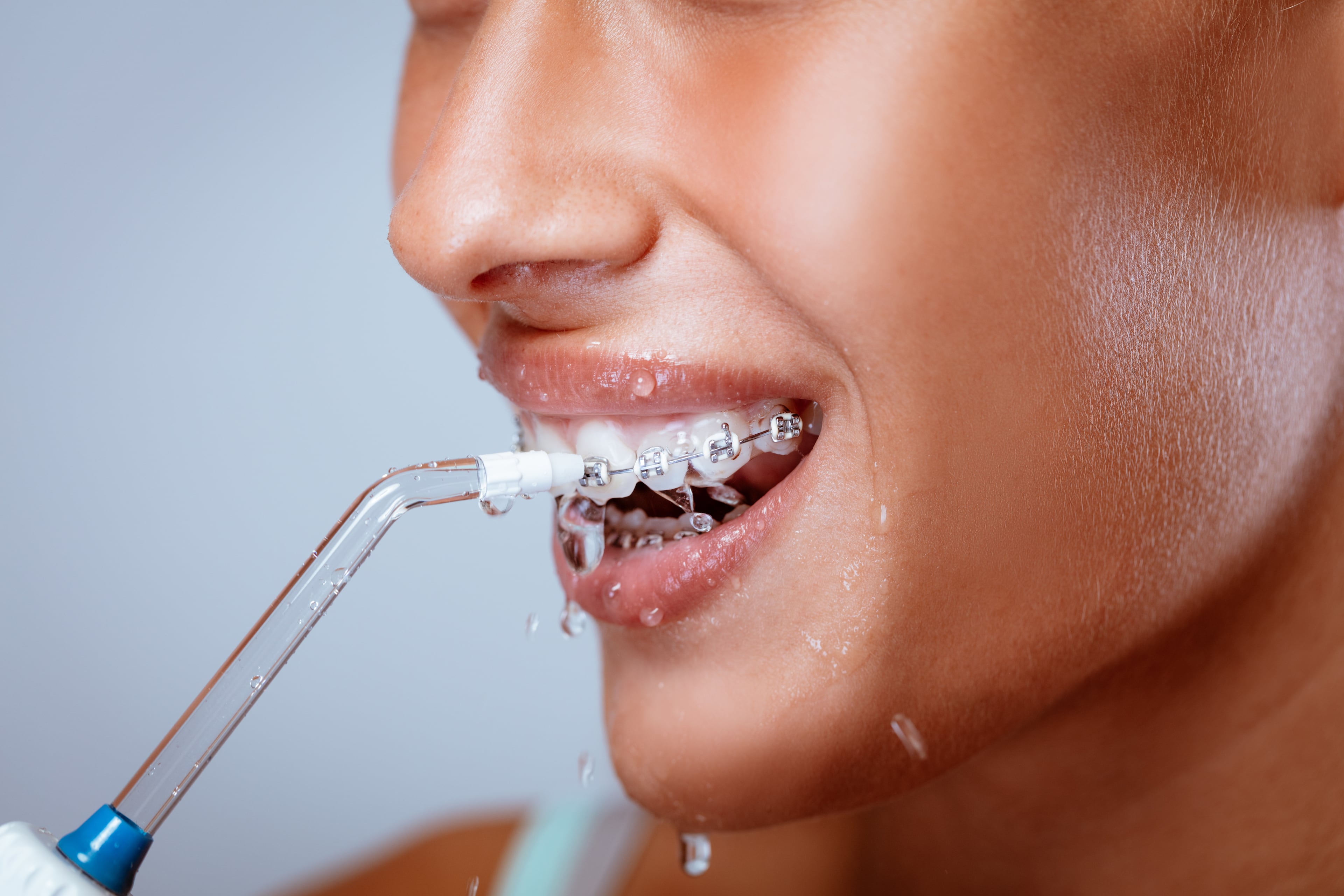 Как почистить зубы ирригатором отбеливание зубов светодиодами