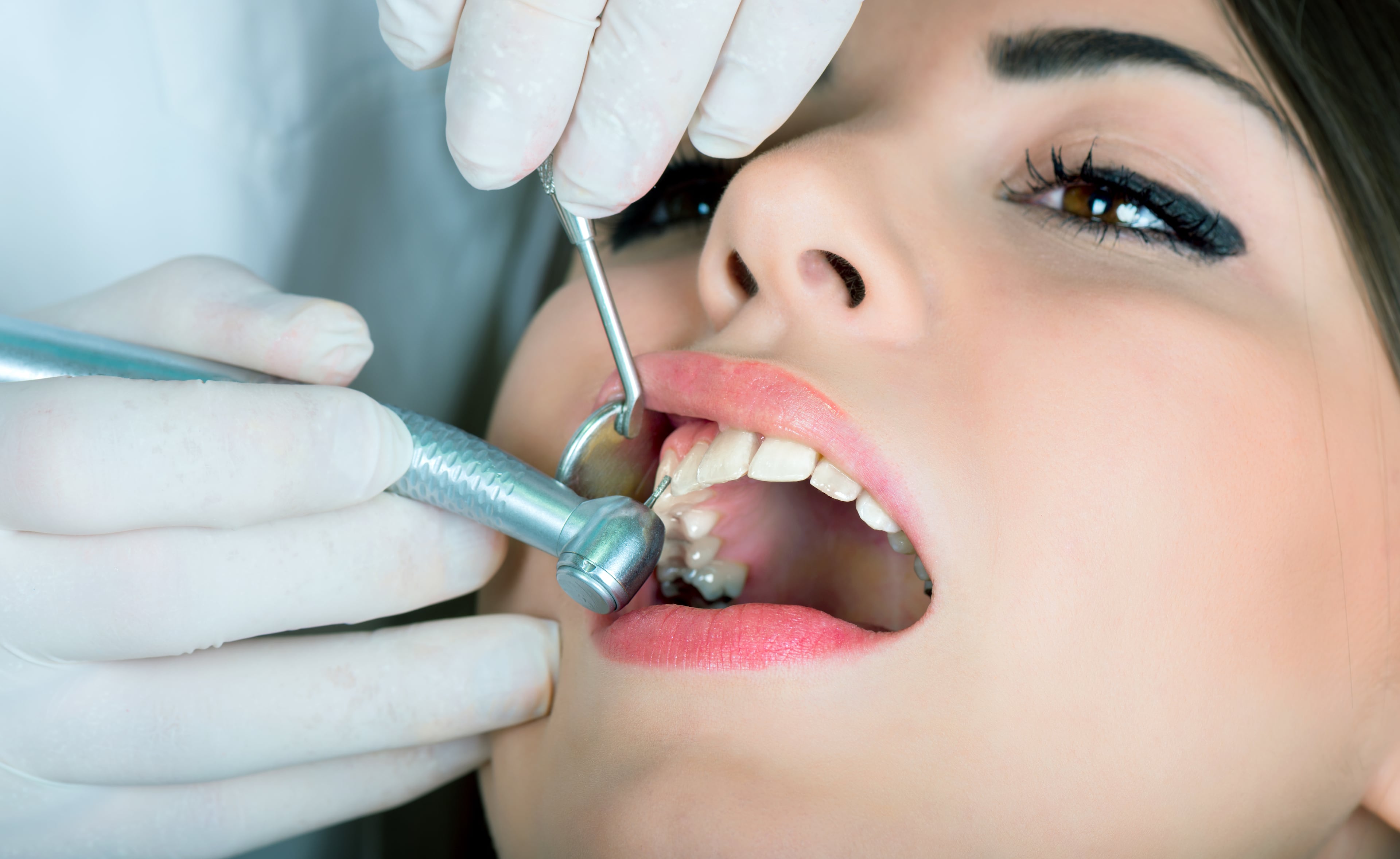 Восстановление полости рта. Пломбы стоматологические.